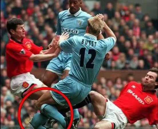 A Perna de David Busst 28 Anos Após o Terrível Acidente que Chocou o Mundo do Futebol!