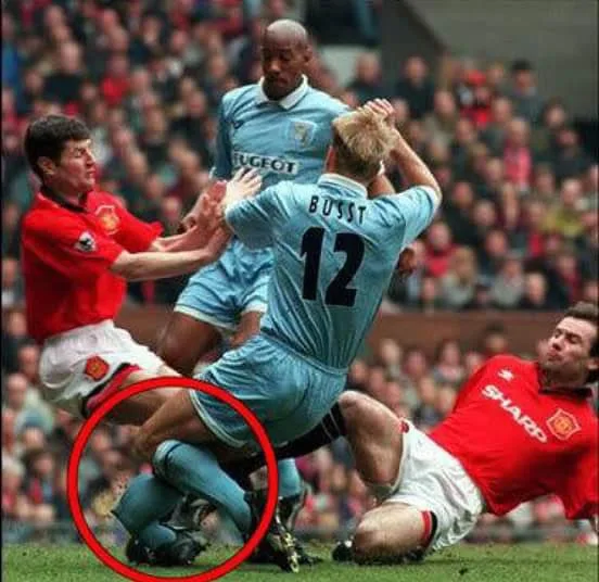 A Perna de David Busst 28 Anos Após o Terrível Acidente que Chocou o Mundo do Futebol!