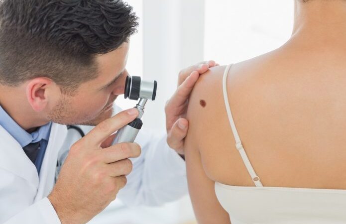 Células mutantes revelam alvos de medicamentos contra o câncer de pele