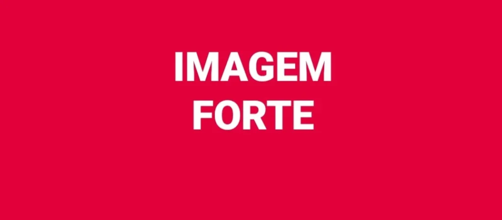 Duas Mulheres Atropeladas por Trem em Comunidade no Rio