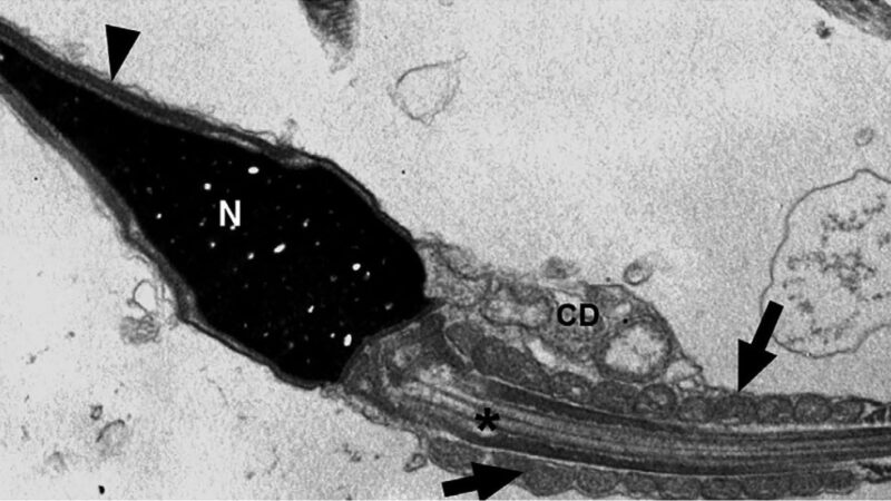 Vírus da COVID-19 pode permanecer no espermatozoide até 110 dias após a infecção