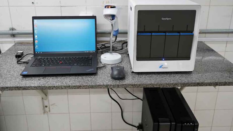 Volta Redonda recebe equipamento para diagnóstico rápido de tuberculose