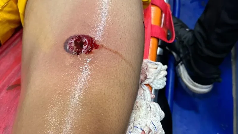 Policial atira com bala de borracha em goleiro durante jogo