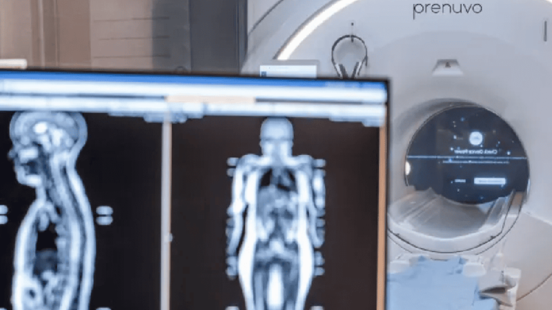 Exame de ressonância magnética vendido pela empresa Prenuvo.