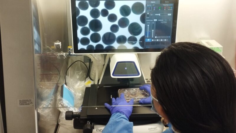 Estudo aponta relação entre aumento do cérebro e gravidade de sintomas no transtorno do espectro autista