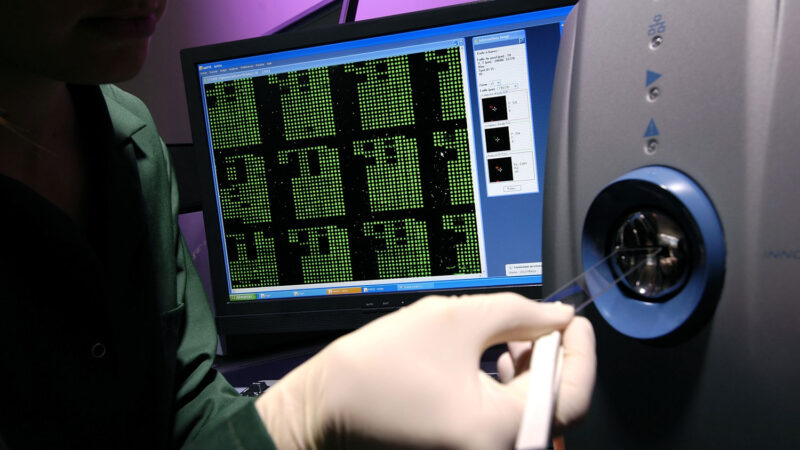 Estudo identifica biomarcadores que poderão auxiliar no diagnóstico da bipolaridade depressiva