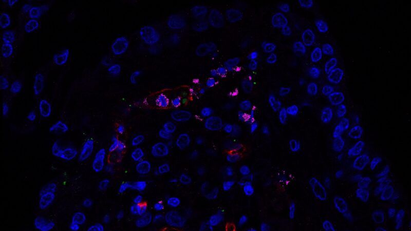 inflamação pulmonar exacerbada ou alta replicação viral